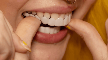 Brilliva - Sofortige Clip-On Zahnverblender für Ober- und Unterkieferzähne