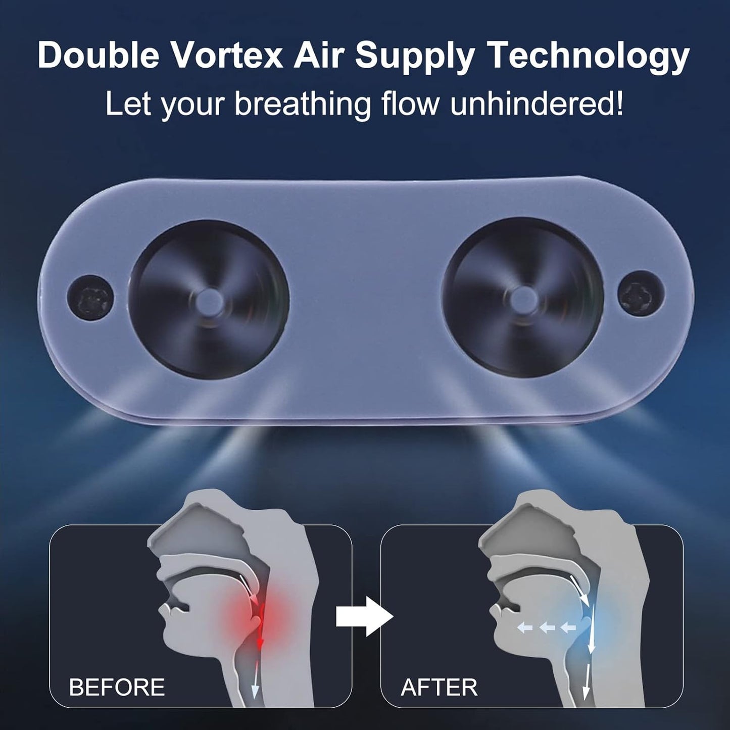 Respilux - Mikro CPAP-Gerät für Schlafapnoe auf Reisen & Anti-Schnarchen – Alternative zur CPAP