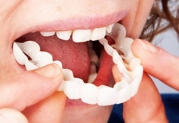 Sérénident - Flexible anpassbare Prothese