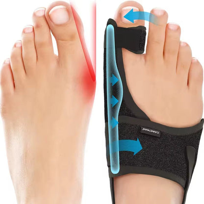 Ergonomischer Hallux Valgus Korrektor – Verstellbare Zehenkorrektur Schiene für schmerzfreie Füße
